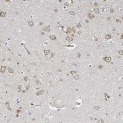 MMP-16/MT3-MMP Antibody, Novus Biologicals 0.1 mL | Buy Online | Novus Biologicals | Fisher Scientific