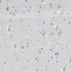 MMP-16/MT3-MMP Antibody, Novus Biologicals 0.1 mL | Buy Online | Novus Biologicals | Fisher Scientific