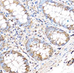 MMP-17 Antibody - Azide and BSA Free, Novus Biologicals 0.1 mL; Unconjugated:Antibodies,