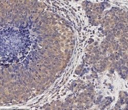 MMP-2 Antibody (2C1) - (Pro and Active) - Azide and BSA Free, Novus Biologicals