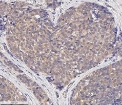 MMP-2 Antibody (2C1) - (Pro and Active) - Azide and BSA Free, Novus Biologicals