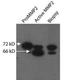 MMP-2 Antibody (8B4) - (Pro and Active) - Azide and BSA Free, Novus Biologicals