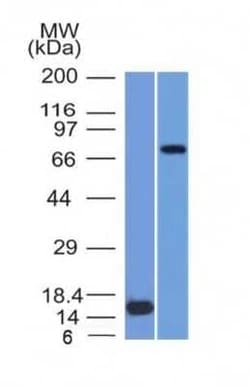 MMP-2 Antibody (MMP2/1501), Novus Biologicals 20&mu;g; Unlabeled:Antibodies,