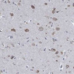 MMP-24/MT5-MMP Rabbit anti-Human, Polyclonal, Novus Biologicals 25 &mu;g;