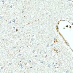 MMP-7 Rabbit anti-Human, Mouse, Rat, Clone: 9D8S10, Novus Biologicals 100