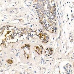 MMP-7 Rabbit anti-Human, Mouse, Rat, Clone: 9D8S10, Novus Biologicals 100