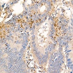 MMP-7 Rabbit anti-Human, Mouse, Rat, Clone: 9D8S10, Novus Biologicals 100