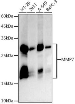 MMP-7 Rabbit anti-Human, Mouse, Rat, Clone: 9D8S10, Novus Biologicals 100