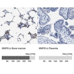 MMP-8 Antibody, Novus Biologicals:Antibodies:Primary Antibodies