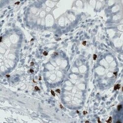 MMP-9 Antibody (CL0538), Novus Biologicals 25 &mu;L, Unconjugated:Antibodies,