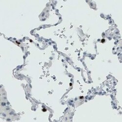 MMP-9 Antibody (CL0538), Novus Biologicals 25 &mu;L, Unconjugated:Antibodies,