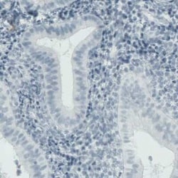 MMP-9 Antibody (CL0538), Novus Biologicals 25 &mu;L, Unconjugated:Antibodies,