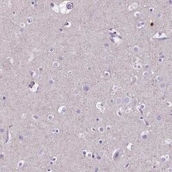 MMP-9 Antibody, Novus Biologicals 0.1 mL | Buy Online | Novus Biologicals | Fisher Scientific