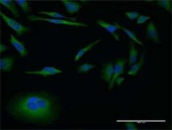 Novus Biologicals MMP26 Antibody (3B9), Novus Biologicals 50 &mu;g | Buy Online | Novus Biologicals&trade; | Fisher Scientific