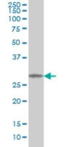MMP26 Antibody (6C6), Novus Biologicals 0.1 mg | Buy Online | Novus Biologicals | Fisher Scientific
