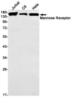 MMR/CD206/Mannose Receptor Rabbit anti-Human, Clone: S06-5I1, Novus Biologicals:Antibodies:Primary