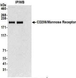 MMR/CD206/Mannose Receptor Antibody (BLR109H), Novus Biologicals 100 &mu;g;