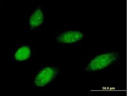 MMS19 like protein Antibody, Novus Biologicals 0.05 mg | Buy Online | Novus Biologicals | Fisher Scientific