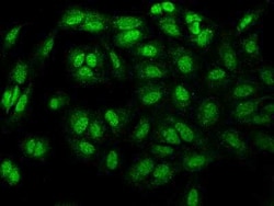 MN1 Antibody, Novus Biologicals 100 &mu;g; Unconjugated:Antibodies, Polyclonal