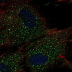 MNAB Antibody, Novus Biologicals:Antibodies:Primary Antibodies