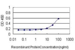 MNK1 Antibody (2C5), Novus Biologicals 0.1 mg, Unconjugated:Antibodies,