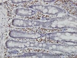 MNK1 Antibody (2F12), Novus Biologicals 0.1 mg | Buy Online | Novus Biologicals | Fisher Scientific