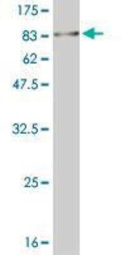 MNK1 Antibody (2F12), Novus Biologicals 0.1 mg | Buy Online | Novus Biologicals | Fisher Scientific