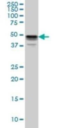 MNK1 Antibody (3E1), Novus Biologicals 0.1 mg | Buy Online | Novus Biologicals | Fisher Scientific