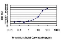 MNK1 Antibody (5E2), Novus Biologicals 0.1 mg | Buy Online | Novus Biologicals | Fisher Scientific