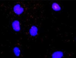 MNK2 Antibody (2A10), Novus Biologicals 0.1 mg | Buy Online | Novus Biologicals | Fisher Scientific