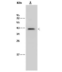 MNX1/HLXB9 Antibody, Novus Biologicals:Antibodies:Primary Antibodies