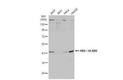 MNX1/HLXB9 Antibody, Novus Biologicals 100 &mu;g | Buy Online | Novus Biologicals | Fisher Scientific