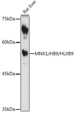 MNX1/HLXB9 Rabbit anti-Human, Mouse, Rat, Polyclonal, Novus Biologicals:Antibodies:Primary