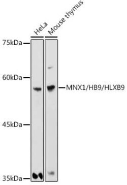 MNX1/HLXB9 Rabbit anti-Human, Mouse, Rat, Polyclonal, Novus Biologicals:Antibodies:Primary