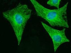 MOB4A/MOBKL1B Antibody (01), Novus Biologicals 50 &mu;g; Unconjugated:Antibodies,