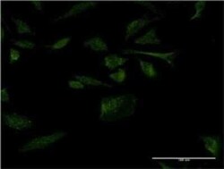 Novus Biologicals MOG1 Antibody (1H4), Novus Biologicals 0.1 mg | Buy Online | Novus Biologicals&trade; | Fisher Scientific