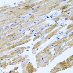MOK Antibody - BSA Free, Novus Biologicals 0.1 mL | Buy Online | Novus Biologicals | Fisher Scientific