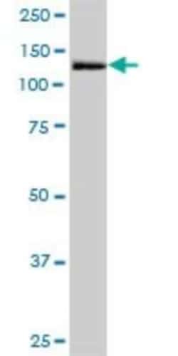 MORC3 Antibody, Novus Biologicals 0.05 mg | Buy Online | Novus Biologicals | Fisher Scientific