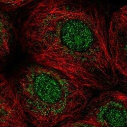 MORN1 Antibody, Novus Biologicals 25 &mu;L | Buy Online | Novus Biologicals | Fisher Scientific