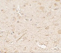 MP1/MAP2K1IP1 Antibody - BSA Free, Novus Biologicals 0.1 mg; Unconjugated:Antibodies,