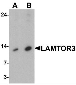 MP1/MAP2K1IP1 Antibody - BSA Free, Novus Biologicals 0.1 mg; Unconjugated:Antibodies,