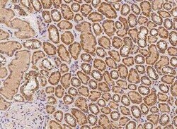 MPHOSPH1 Antibody, Novus Biologicals:Antibodies:Primary Antibodies