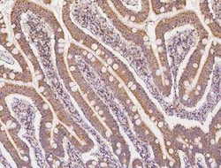MPHOSPH1 Antibody, Novus Biologicals:Antibodies:Primary Antibodies