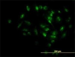 MPHOSPH10 Antibody (1B10), Novus Biologicals 0.1 mg | Buy Online | Novus Biologicals | Fisher Scientific