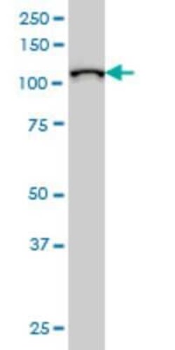 MPHOSPH10 Antibody (1B10), Novus Biologicals 0.1 mg | Buy Online | Novus Biologicals | Fisher Scientific