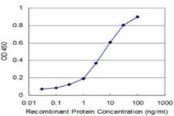 MPHOSPH10 Antibody (1E12), Novus Biologicals 0.1 mg | Buy Online | Novus Biologicals | Fisher Scientific