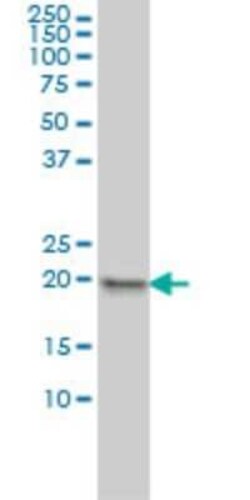 MPHOSPH6 Antibody (1D8-2A8), Novus Biologicals 0.1 mg | Buy Online | Novus Biologicals | Fisher Scientific