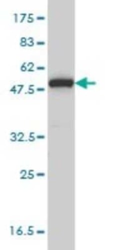 MPP1 Antibody (1C3-1D11), Novus Biologicals 0.1 mg | Buy Online | Novus Biologicals | Fisher Scientific