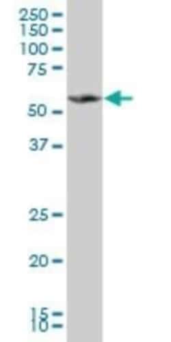 MPP1 Antibody (2E5), Novus Biologicals 0.1 mg, Unconjugated:Anticuerpos