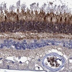 MPP1 Rabbit anti-Human, Polyclonal, Novus Biologicals:Antibodies:Primary
